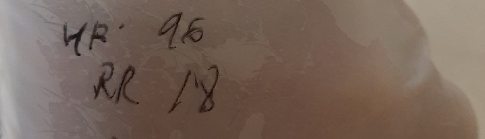 Image of hand in glove with vital signs written on it.